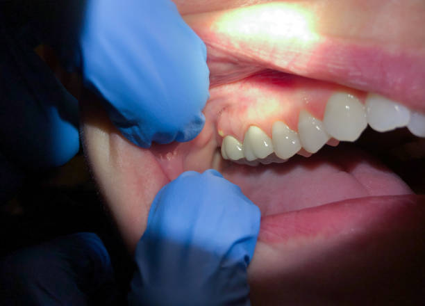Best Emergency Dental Services for Seniors in East Franklin, NJ