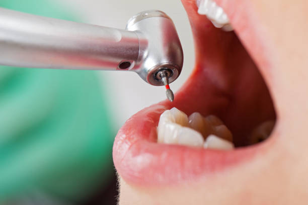 Best Emergency Dentist for Knocked-Out Tooth in East Franklin, NJ